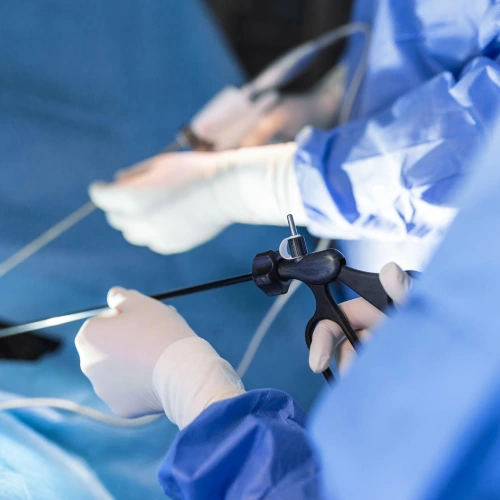 Servicio de cirugia de vesicula en tijuana